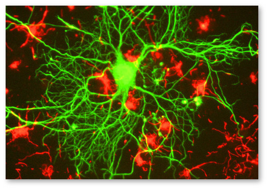 alzheimers-cannabinoids