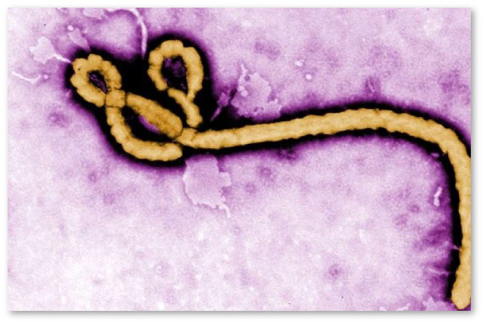 ebola-virus-pulse-ng