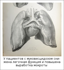 У пациентов с муковисцидозом снижена легочная функция и повышена выработка мокроты