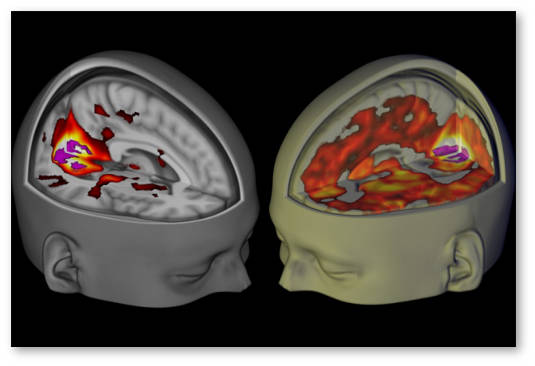 lsd issledovaniya terapevticheskih svojstv