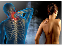 Еще одна болезнь, которая лучше лечится марихуаной, чем аптечными лекарствами