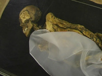 "Алтайская принцесса" страдала раком молочной железы, от которого, возможно, лечилась марихуаной