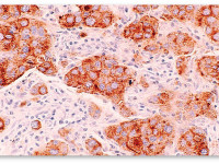Исследование: Марихуана поможет бороться с раком груди Исследование: Марихуана поможет бороться с раком груди