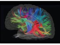 Конопля может защитить стареющий мозг, говорят эксперты
