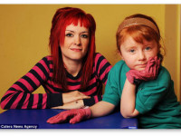 5 главных полезных свойств конопли при буллезном эпидермолизе