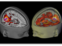 Наука: Изучение воздействия ЛСД на мозг человека