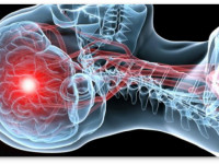 Курение марихуаны связано с меньшим риском инсульта