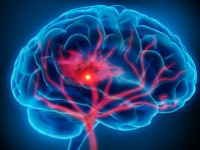 Медицина: Употребление конопли снижает вероятность тромбов и инсульта